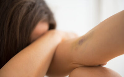 Why Gender Matters in the Study and Treatment of Substance Use Disorders